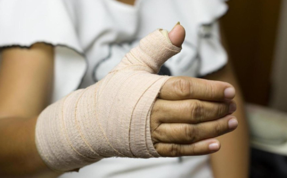 У Луцьку школярка на фізкультурі зламала руку, вчитель проігнорував інцидент