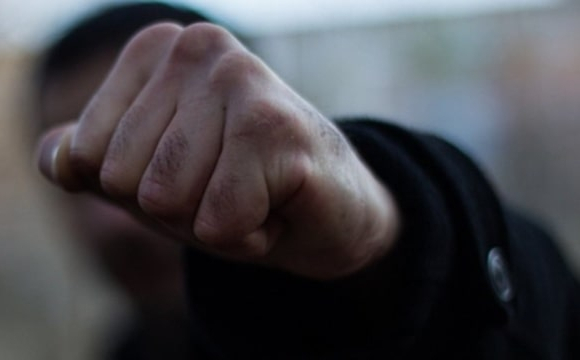 На Волині пенсіонер вдарив дитину в обличчя