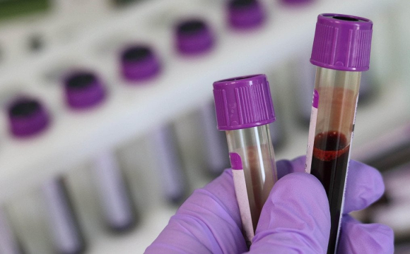 Вчені відтворили вірус, який забрав життя 100 мільйонів людей