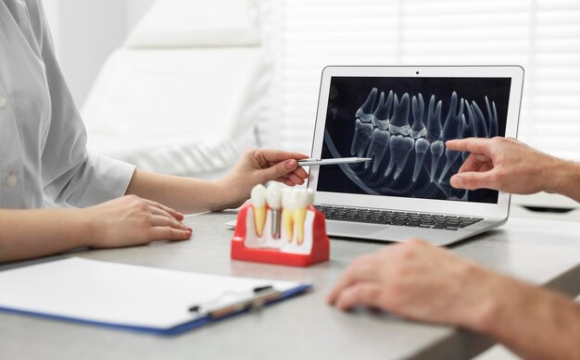 Як обрати клініку для імплантації зубів: ключові орієнтири для пацієнта