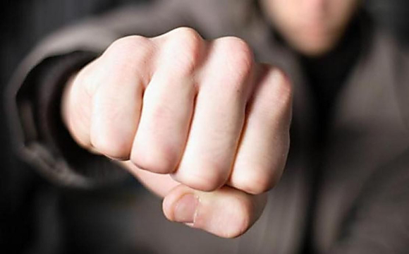 У Луцьку двоє п’яних хлопців побили чоловіка після відмови дати їм 10 гривень