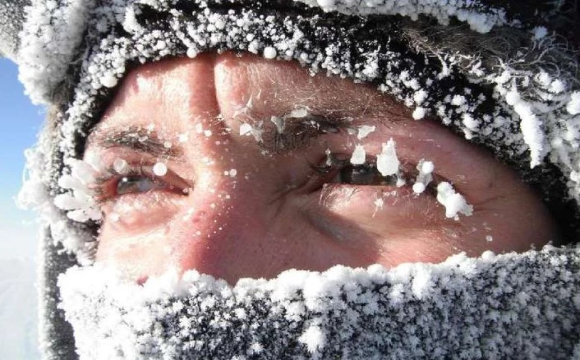 У Рівненській області троє людей потрапили до лікарні через обмороження